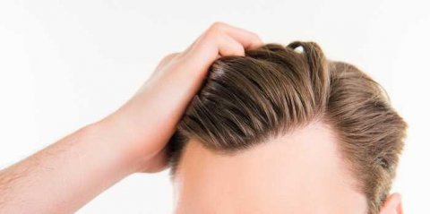 La greffe de cheveux FUE contre l’alopécie à Lyon. Centre Esthétique Roosevelt