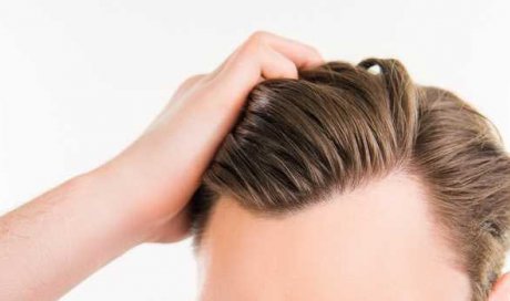 La greffe de cheveux FUE contre l’alopécie à Lyon. Centre Esthétique Roosevelt